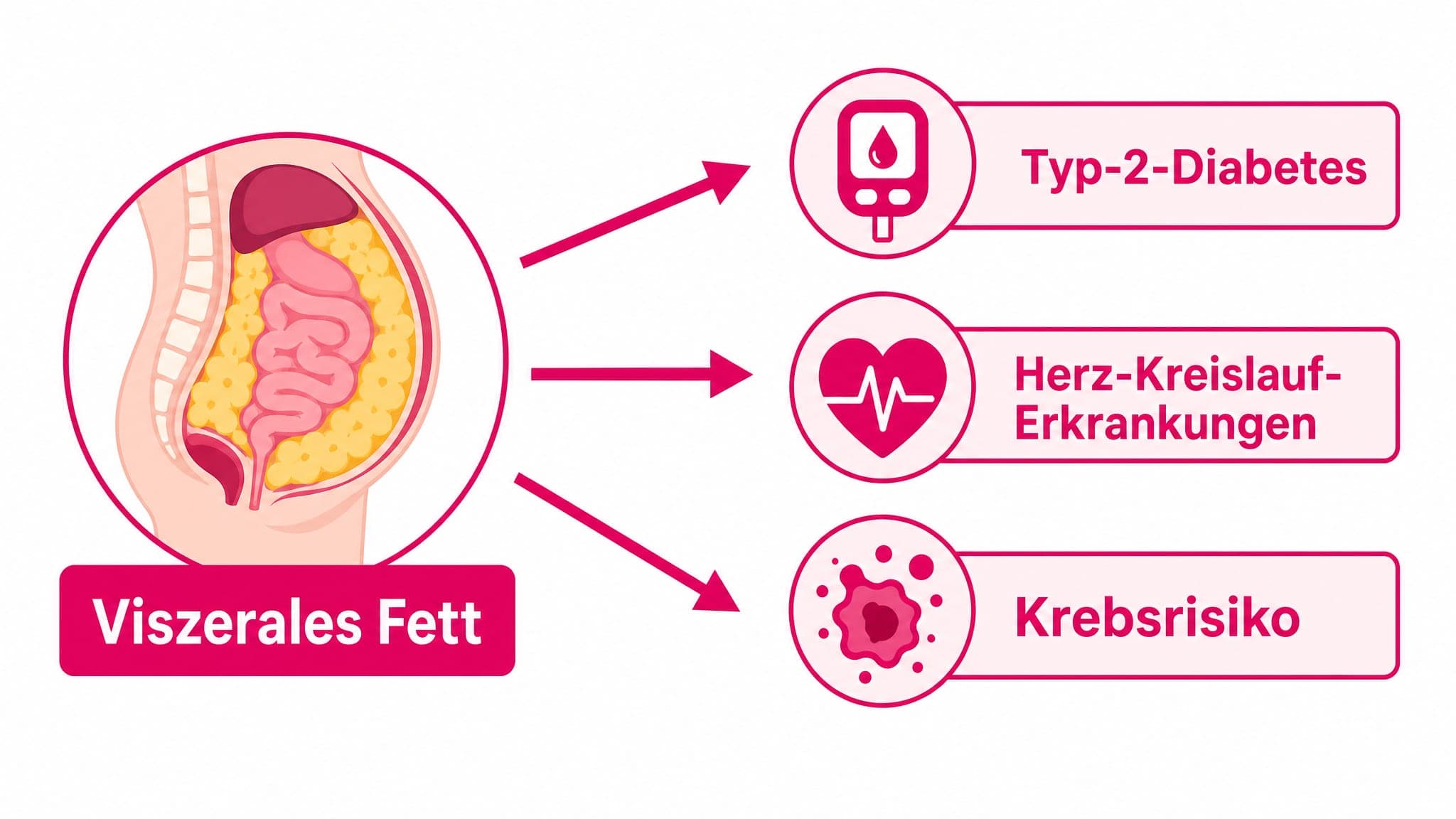 Pfeile zeigen von einer stilisierte Bauchfett-Darstellung zu Symbolen für Diabetes, Herzerkrankungen und Krebs.