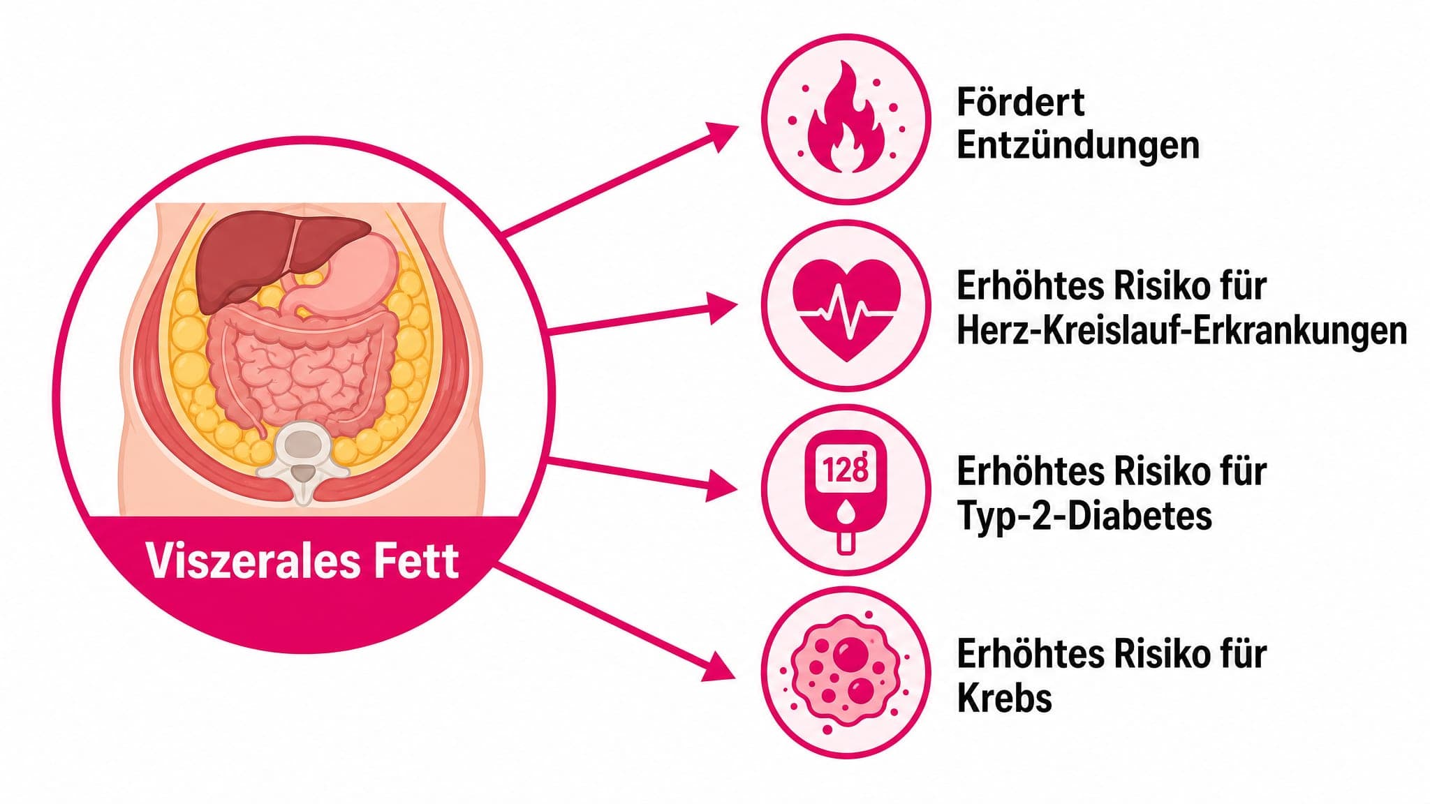 Pfeildiagramm zeigt viszerales Fett als Ursache für Entzündungen und erhöhtes Risiko für Herz-Kreislauf-Erkrankungen, Typ-2-D